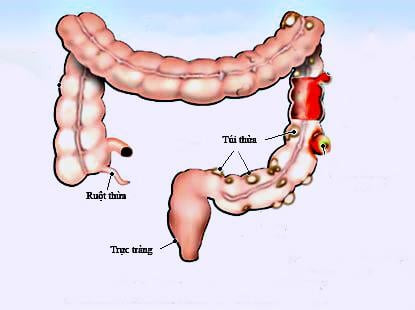 12 Nguyên Nhân Gây Đau Xương Chậu Ở Phụ Nữ